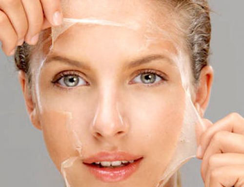 Chemical Peels – For a Fresh And Younger Skin