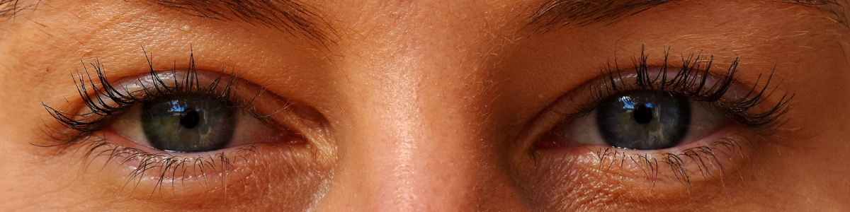 OPTICAL 1